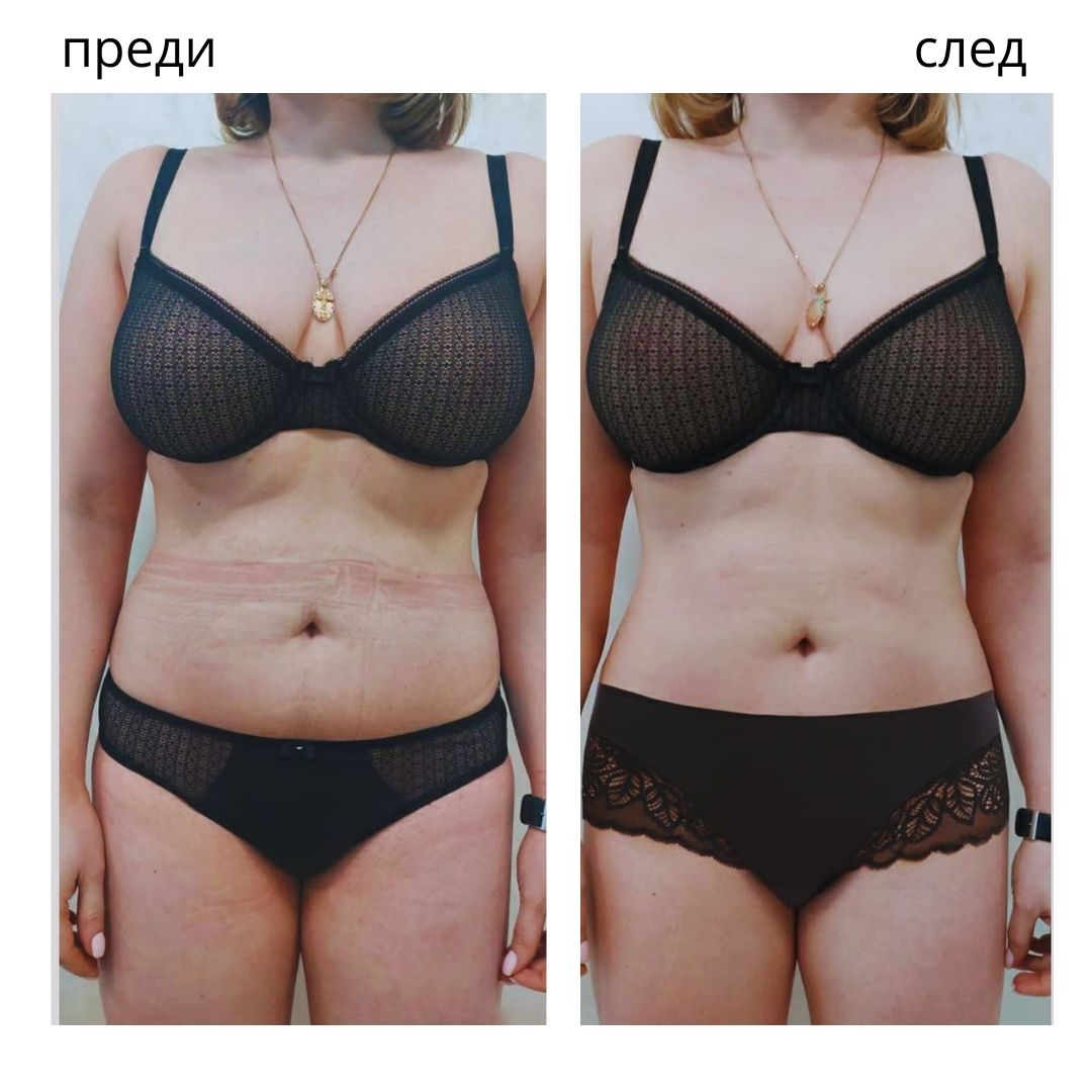 PowerShape 2 резултат преди и след за тяло в Бургас